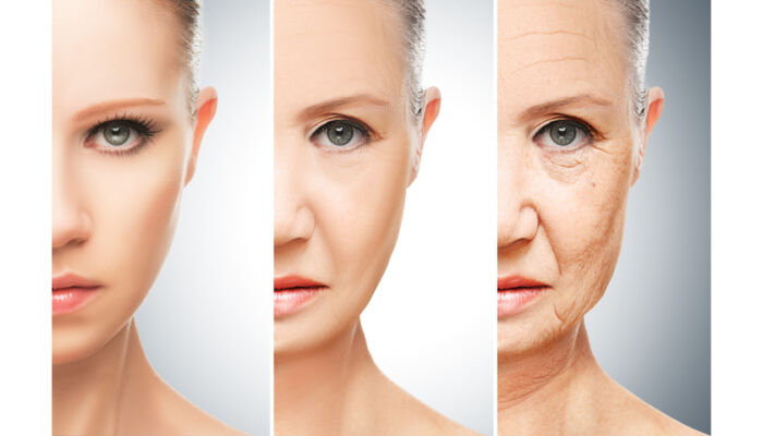 a bőr alatti zsír öregedésének elvesztése
